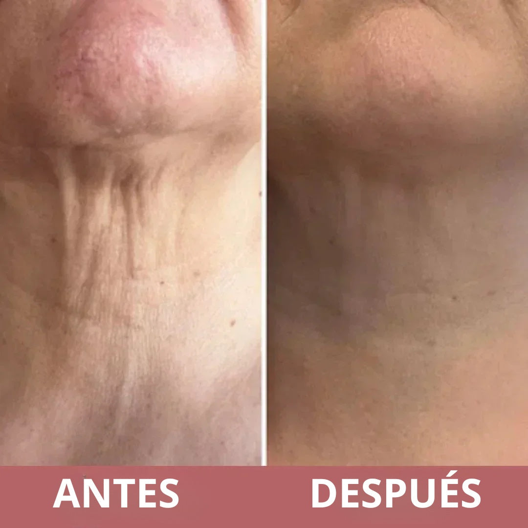 Antes y después