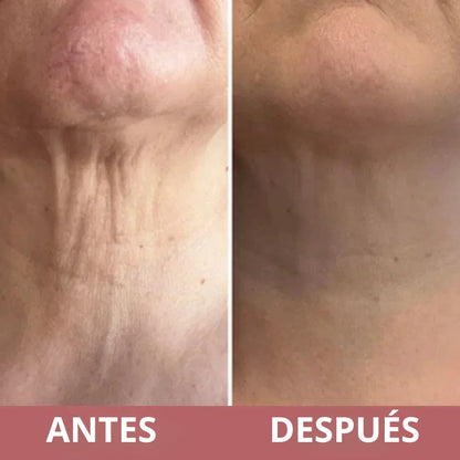 Antes y después